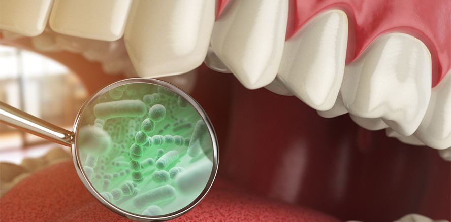 Höhle der Löwen: Veganes Parodont-Gel schnappt sich den „Deal“