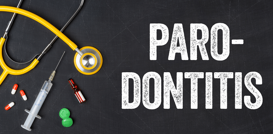 Bayerns Zahnärzte sind führend bei der Parodontitis-Erkennung