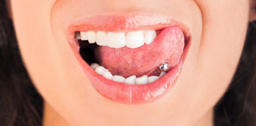 Zusammenhang zwischen Piercings und Parodontitis aufgedeckt