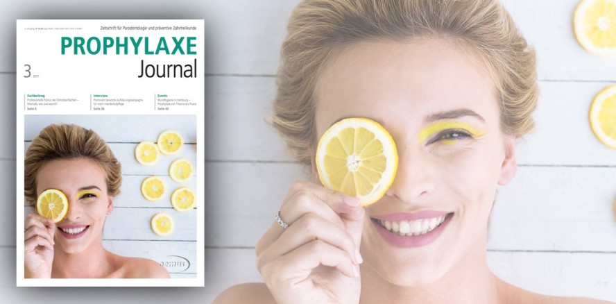 Politur, Munddusche & Co. – Aktuelles Prophylaxe Journal online