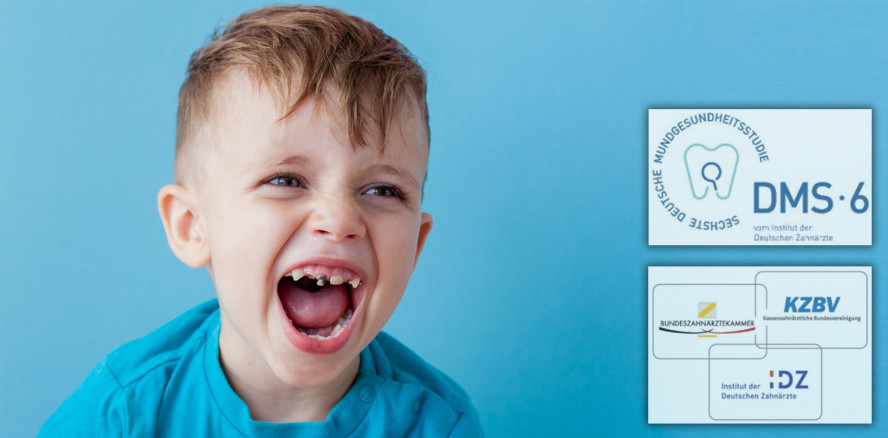 Sechste Deutsche Mundgesundheitsstudie gestartet