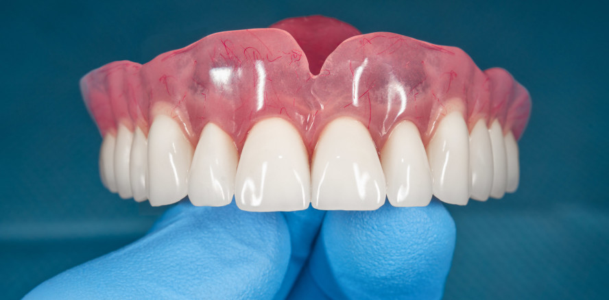 Update der Leitlinie zur Versorgung des zahnlosen Oberkiefers