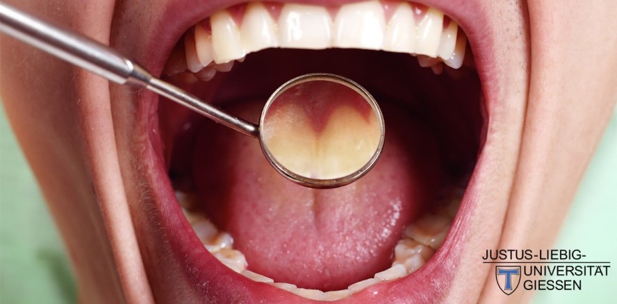 Studie zur Mundhygiene: Wie sauber putzen Zahnarzt, ZFA & Co.?