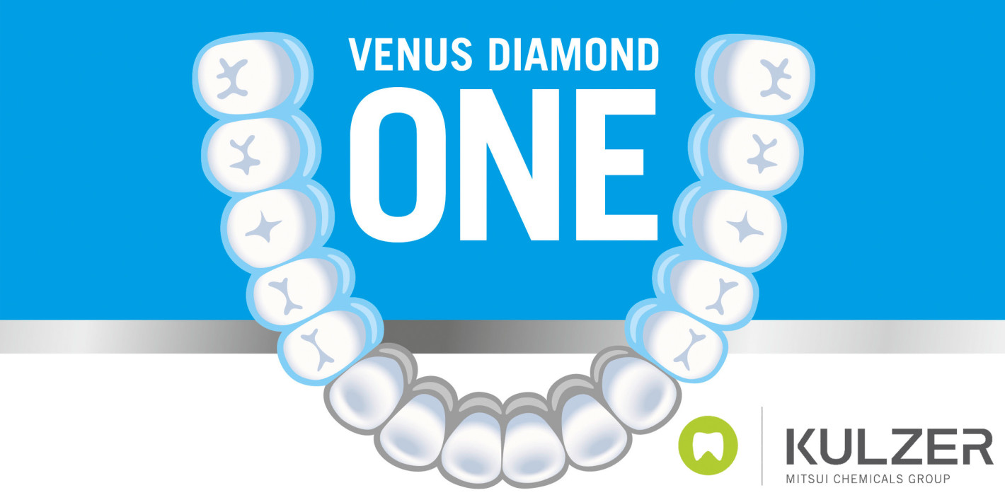 Kulzer lüftet das Geheimnis um Venus Diamond ONE