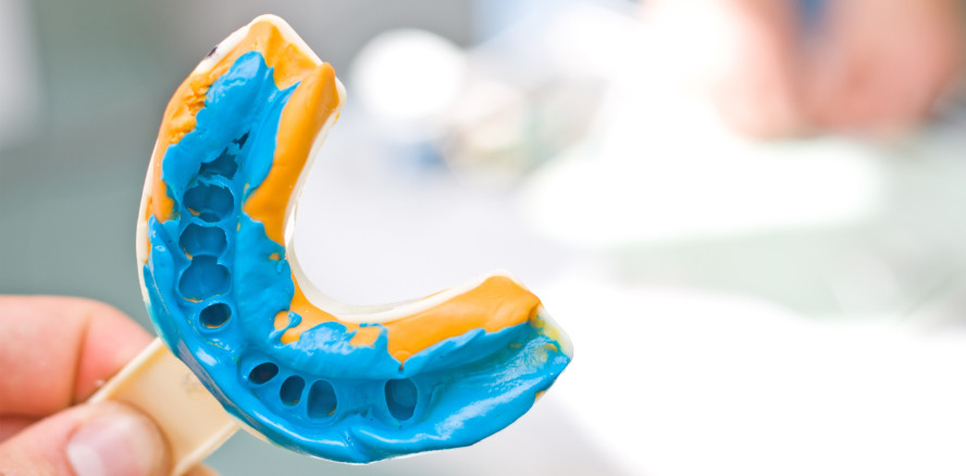 Unterkieferprotrusionsschiene wird Kassenleistung