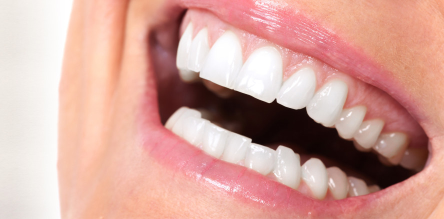 Spezieller Laser gegen dunkle Zahnfleischverfärbungen