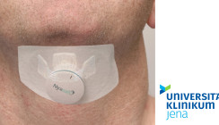 Jenaer HNO-Uniklinik testet neues Zungenschrittmachersystem