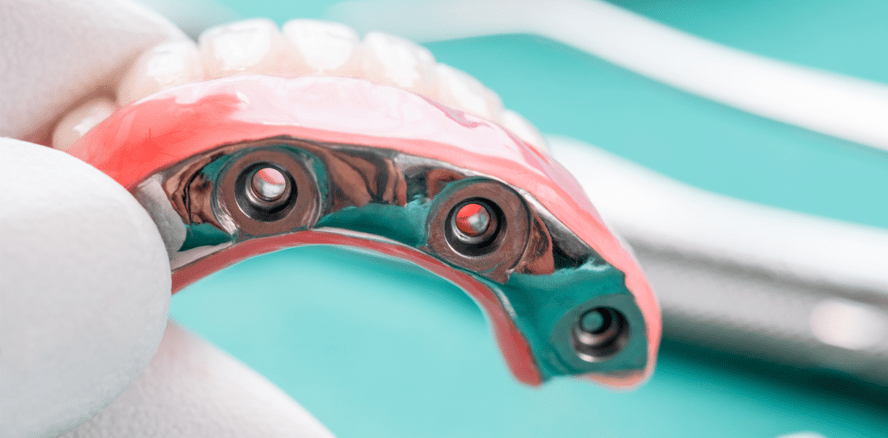 Verwendung von Cobalt in Dentallegierungen gerechtfertigt