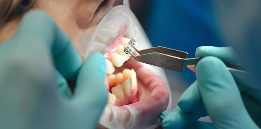 Fachzahnarztausbildung für Kieferorthopädie