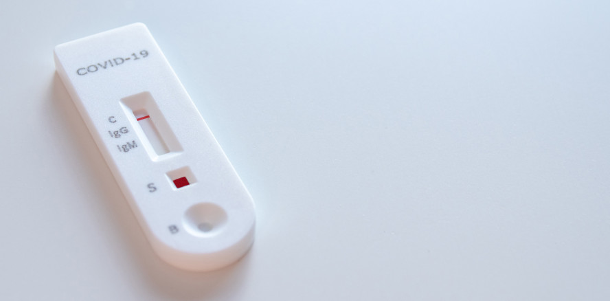 Zahnarztpraxen dürfen Antigentests durchführen