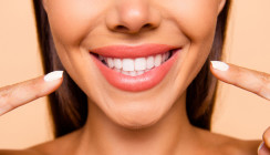 „Upfala“: Posh Spice mit neuen Veneers und Sprachfehler