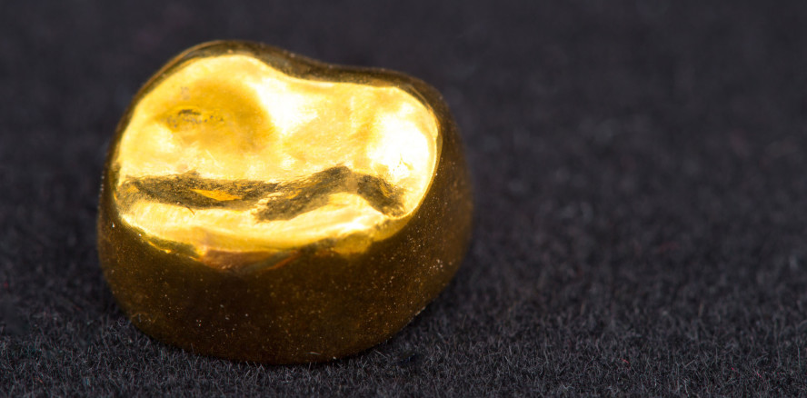 Praktikantin lässt Zahngold im Wert von 10.000 Euro mitgehen