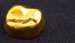 Praktikantin lässt Zahngold im Wert von 10.000 Euro mitgehen