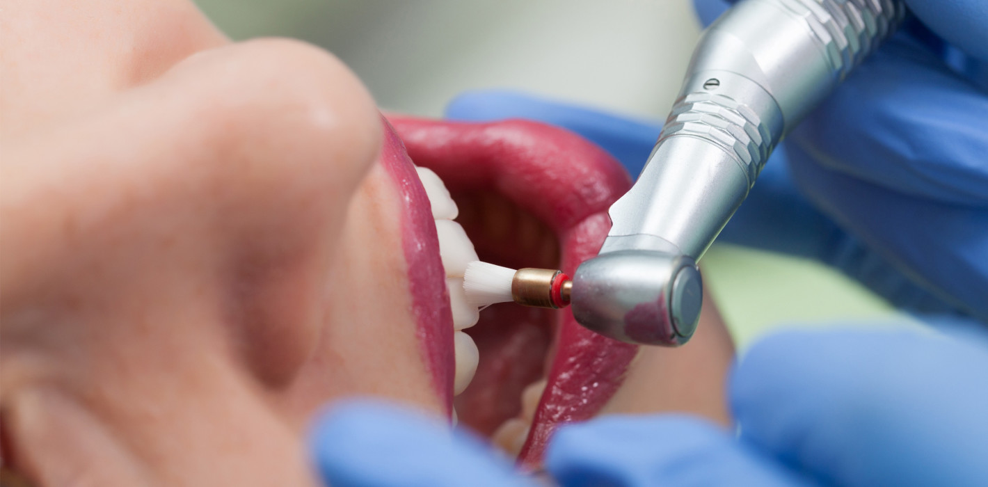 Tipps für einen erfolgreichen Start in der Prophylaxe