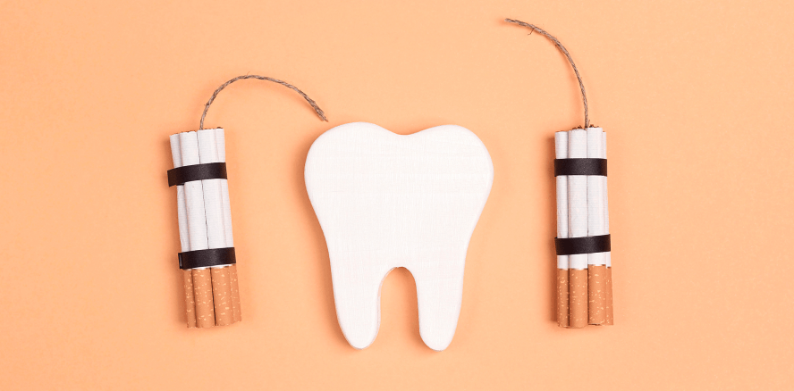 Im Vergleich: Zahnverfärbungen bei Rauchern und Nichtrauchern