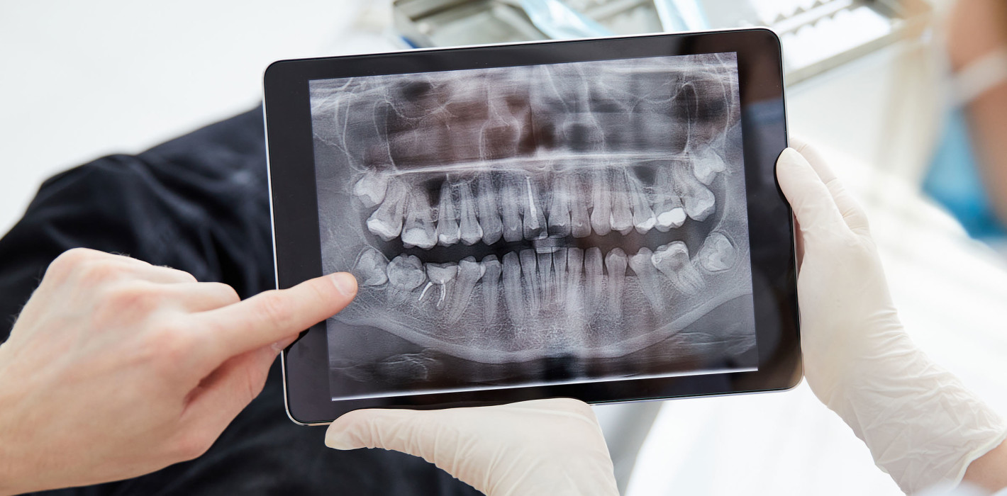 KI in der dentalen Röntgendiagnostik: Erste klinische Anwendung zeigt über 98 % Genauigkeit