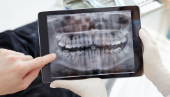 KI in der dentalen Röntgendiagnostik: Erste klinische Anwendung zeigt über 98 % Genauigkeit