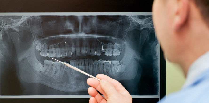 BfS warnt: Unnötige Röntgenanwendungen vermeiden