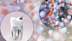 So verschafft sich S. mutans einen Wettbewerbsvorteil
