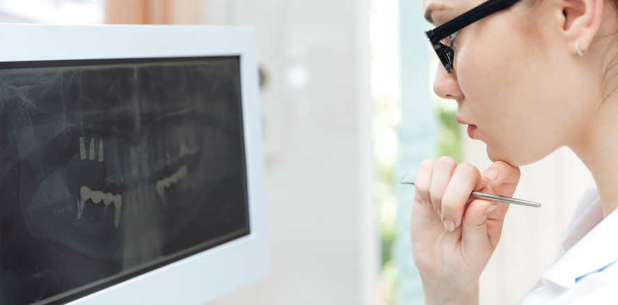 Fehlerhafte Kronenränder: Zahnarzt muss 8.250 EUR zahlen