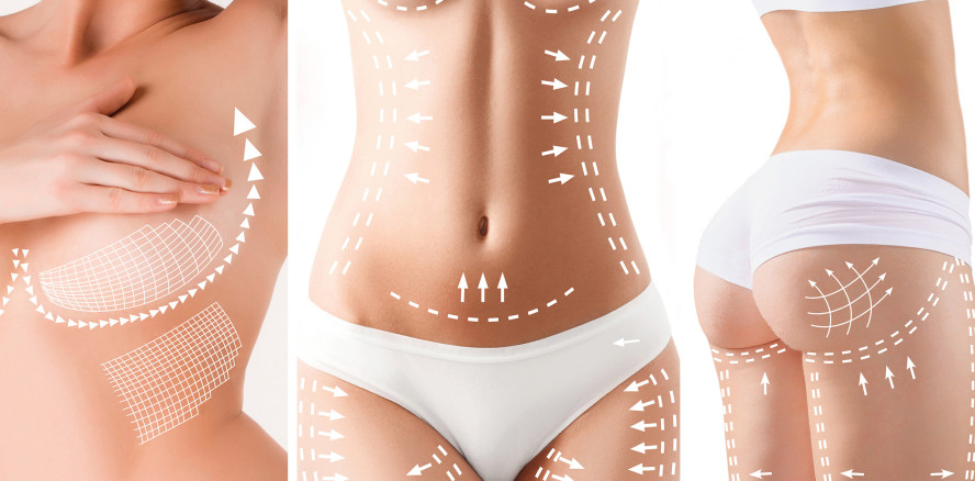 Trend zu Schönheits-OPs in Deutschland hält an