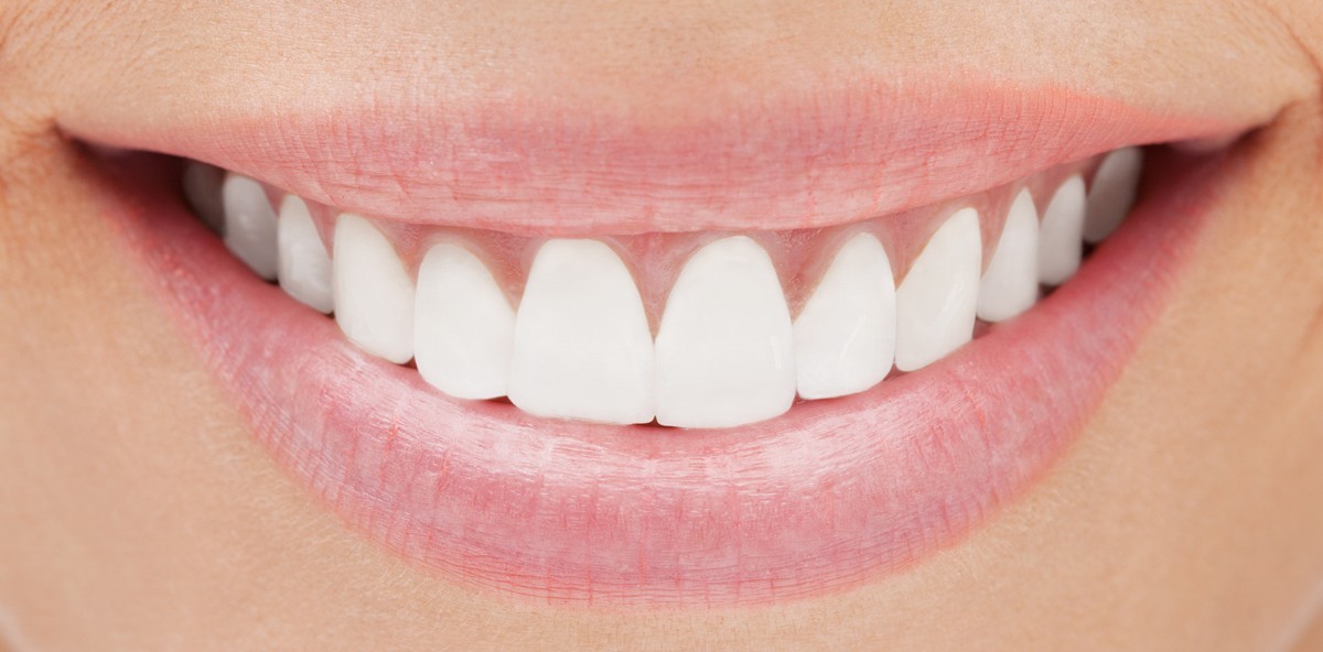 Die Abivardi-Schwestern verkaufen swiss smile