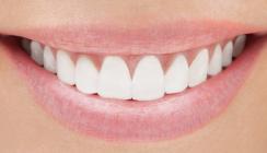 Die Abivardi-Schwestern verkaufen swiss smile