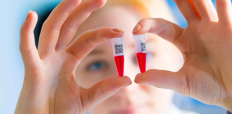 Speichelmikrobiom: Mädchen erkranken häufiger an Karies