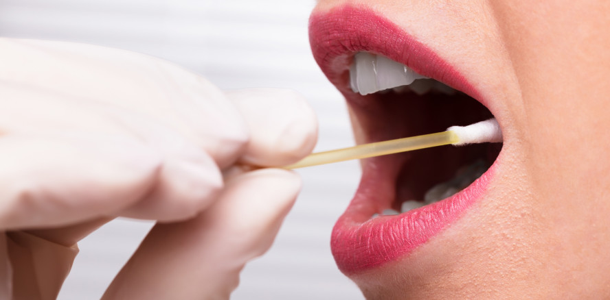 Speichelbiomarker zur Früherkennung von Mundkrebs