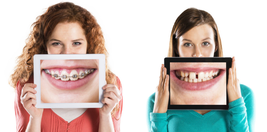 HBSC-Studie: Verbesserungsbedarf bei Mundhygiene