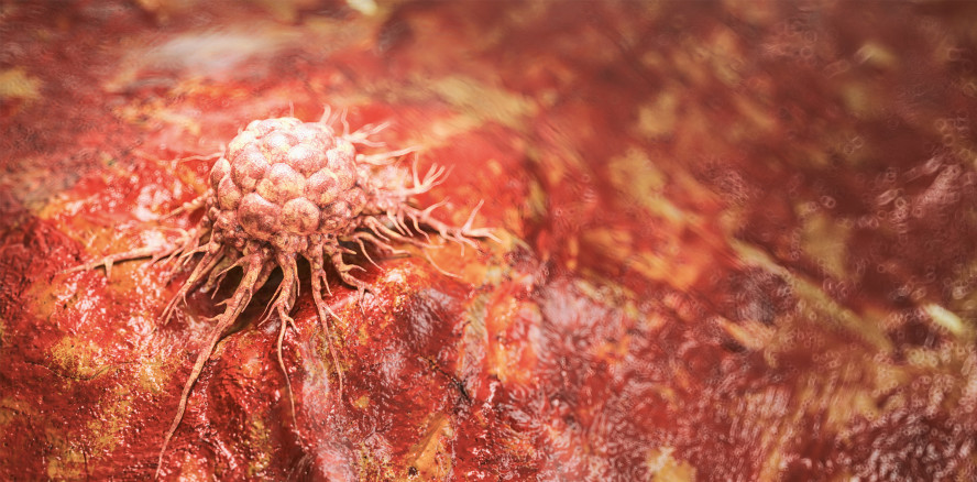 Mundkrebserkennung durch Zahnärzte nimmt signifikant zu