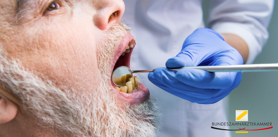 Mundgesundheit bei Menschen mit Unterstützungsbedarf schlecht