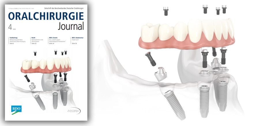 Jetzt online lesen: Vielfältige Themen im aktuellen Oralchirurgie Journal