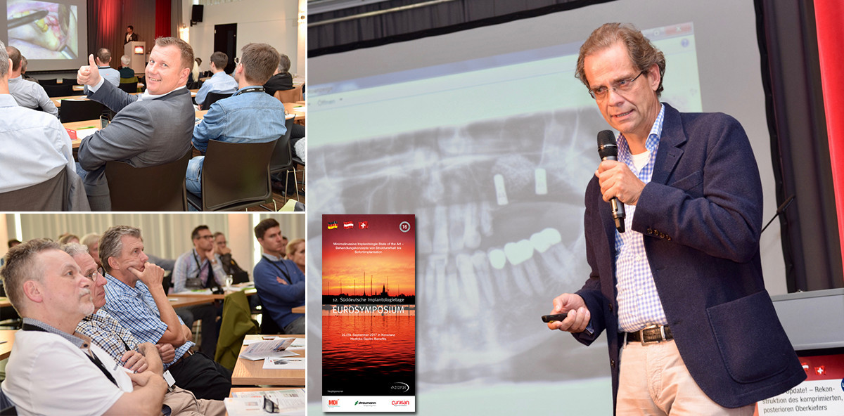 Minimalinvasive Implantologie State of the Art: Implantologie in Konstanz