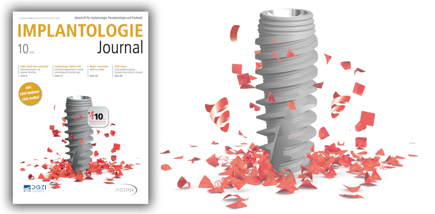 Aktuelles Implantologie Journal: Digitalisierung im Fokus
