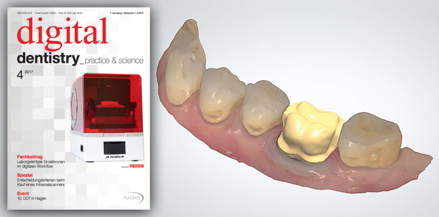 Aktuelle Ausgabe der digital dentistry jetzt als ePaper lesen