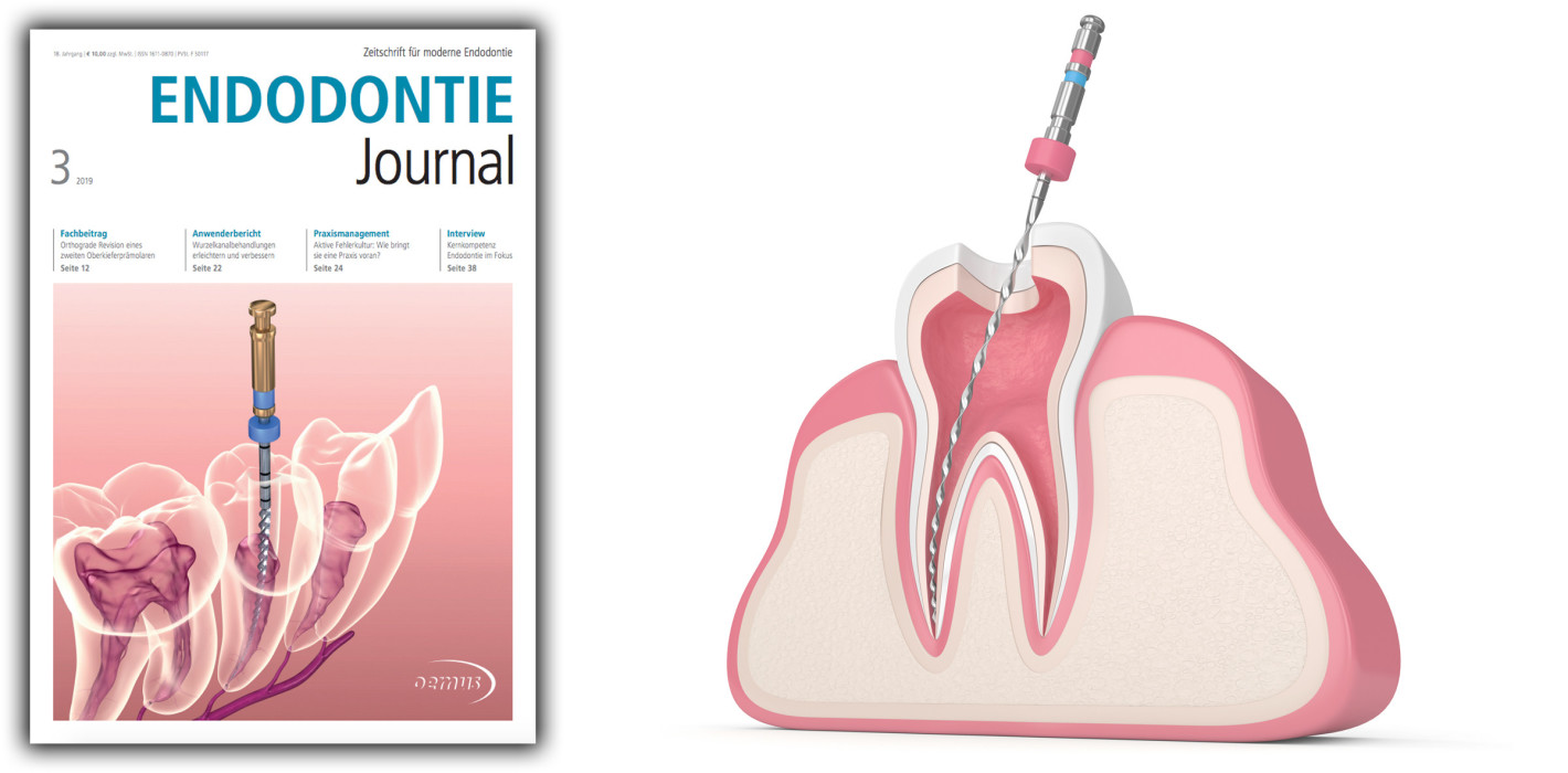 Jetzt als ePaper online: Das aktuelle Endodontie Journal