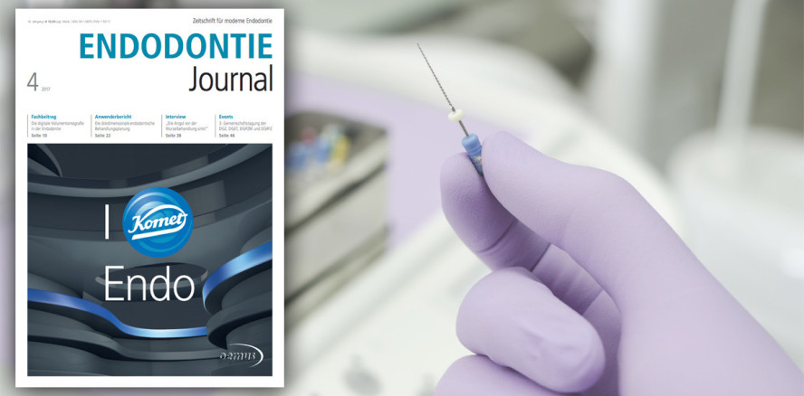 DVT, Laser & Co. – das aktuelle Endodontie Journal ist online