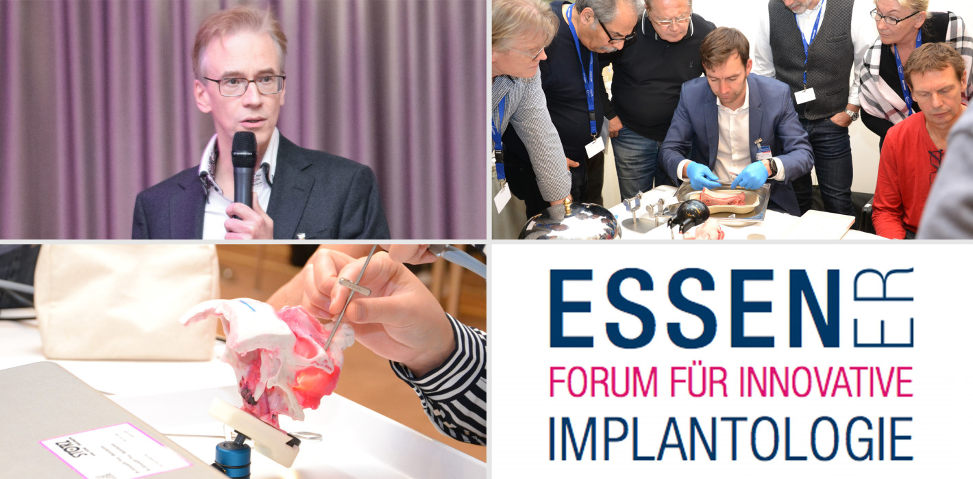 Am 25. und 26. September in Essen – Forum für Innovative Implantologie