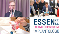 Am 25. und 26. September in Essen – Forum für Innovative Implantologie