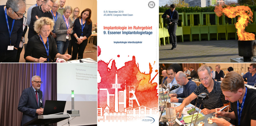 Implantologie interdisziplinär bei den 9. Essener Implantologietagen