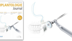Aktuelles Implantologie Journal jetzt online lesen