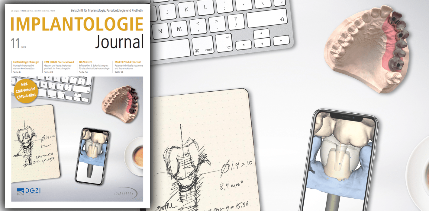 Implantologie Journal mit Fokus „Minimalinvasive Implantattherapie“