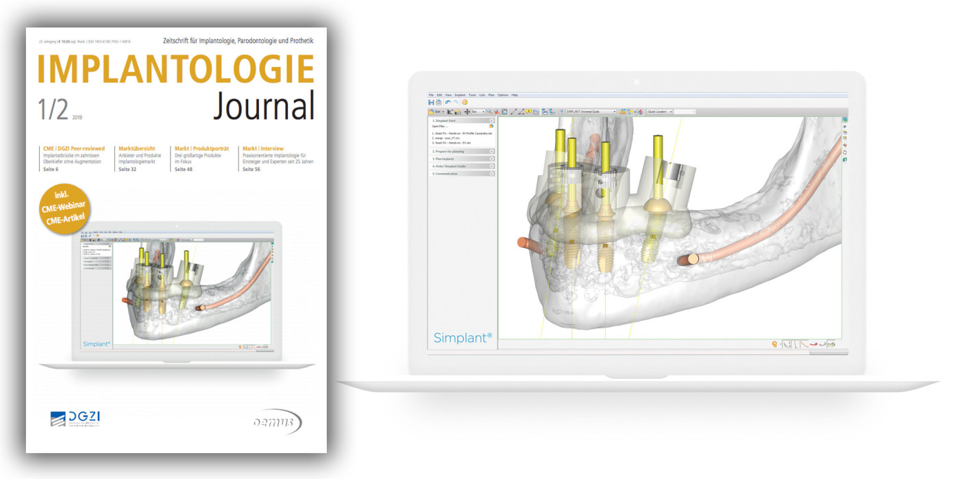Up to date mit dem aktuellen Implantologie Journal