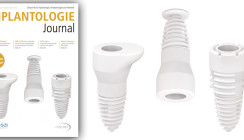 Digitale Implantologie im Fokus des aktuellen Implantologie Journal