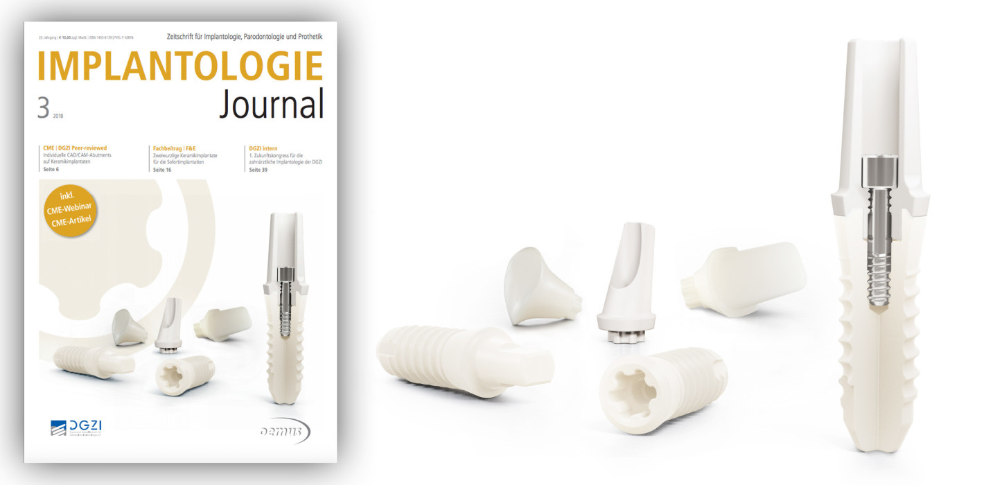 März-Ausgabe des Implantologie Journals jetzt online lesen