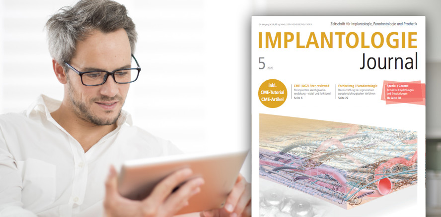 Aktuelles Implantologie Journal: Update zu GBR und GTR