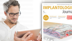 Aktuelles Implantologie Journal: Update zu GBR und GTR