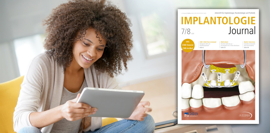 Aktuelles Implantologie Journal fokussiert Keramikimplantate