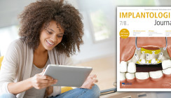 Aktuelles Implantologie Journal fokussiert Keramikimplantate